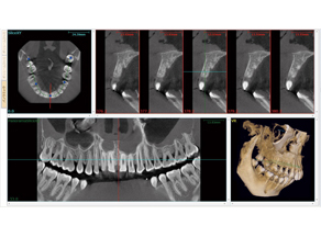 デジタルレントゲン