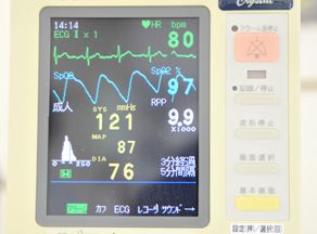 生体情報モニター