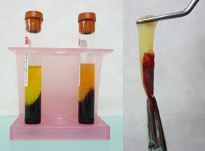 自己血によるCGF